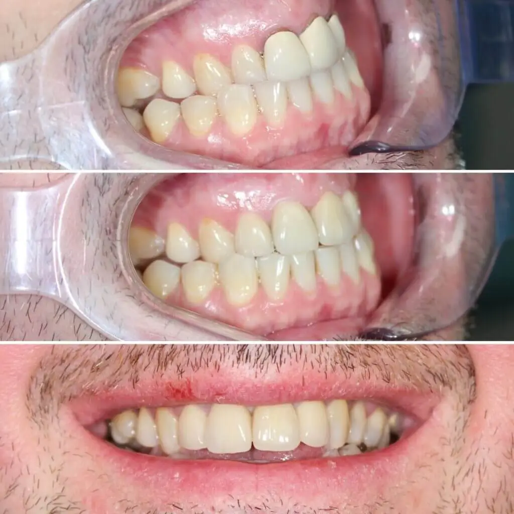 fogászat eset - referencia székesfehérvár