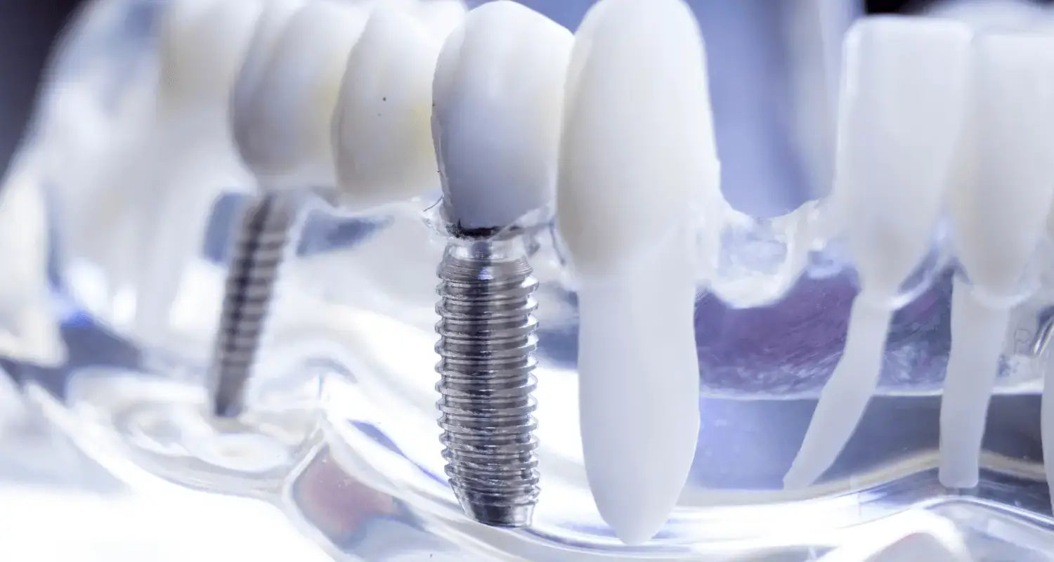 implant